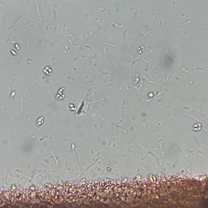  ( - FDS-CA-00321)  @11 [ ] by-nc (2024) Christian Schwarz Fungal Diversity Survey
