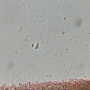  ( - FDS-CA-00321)  @11 [ ] by-nc (2024) Christian Schwarz Fungal Diversity Survey