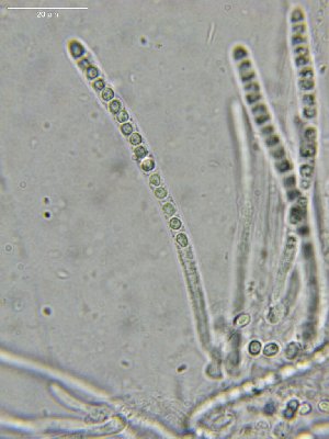  ( - FDS-CA-03807)  @11 [ ] by-nc (2024) Stu Pickell Fungal Diversity Survey