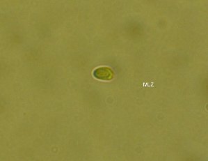  ( - FDS-CA-00346)  @11 [ ] by-nc (2023) Christian Schwarz Fungal Diversity Survey