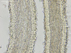  ( - FDS-CA-00346)  @11 [ ] by-nc (2023) Christian Schwarz Fungal Diversity Survey