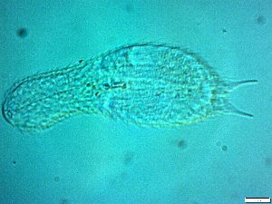  (Chaetonotus bombardus - AMU217.5)  @11 [ ] Copyright (2014) Malgorzata Kolicka Department of Animal Taxonomy and Ecology; Adam Mickiewicz University, Poznan