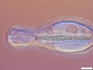  (Chaetonotus aff. heideri 2 - GA_10.6)  @11 [ ] Copyright (2016) Malgorzata Kolicka Department of Animal Taxonomy and Ecology; Adam Mickiewicz University, Poznan