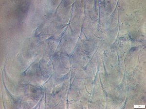  (Chaetonotus aff. heideri - GA_19.21)  @11 [ ] Copyright (2016) Malgorzata Kolicka Department of Animal Taxonomy and Ecology; Adam Mickiewicz University, Poznan