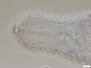  (Chaetonotus aff. bombardus - GA_2.1)  @11 [ ] Copyright (2016) Malgorzata Kolicka Department of Animal Taxonomy and Ecology; Adam Mickiewicz University, Poznan