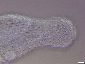  (Chaetonotus cf. gelidus - GA_21.2)  @11 [ ] Copyright (2016) Malgorzata Kolicka Department of Animal Taxonomy and Ecology; Adam Mickiewicz University, Poznan