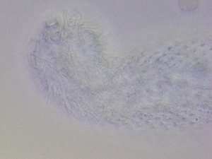  (Chaetonotus aff. gelidus - HA_22.29)  @11 [ ] CreativeCommons  Attribution Non-Commercial (2016) Malgorzata Kolicka Department of Animal Taxonomy and Ecology Adam Mickiewicz University Poznan