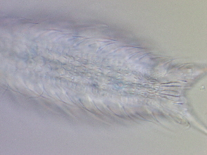  (Chaetonotus hornsundi - HA_19.39)  @11 [ ] CreativeCommons  Attribution Non-Commercial (2016) Malgorzata Kolicka Department of Animal Taxonomy and Ecology Adam Mickiewicz University Poznan