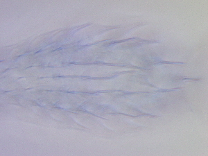  ( - HA_19.39)  @11 [ ] CreativeCommons  Attribution Non-Commercial (2016) Malgorzata Kolicka Department of Animal Taxonomy and Ecology Adam Mickiewicz University Poznan