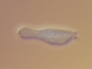 (Chaetonotus jaceki - HA_24.128)  @11 [ ] CreativeCommons  Attribution Non-Commercial (2016) Malgorzata Kolicka Department of Animal Taxonomy and Ecology Adam Mickiewicz University Poznan