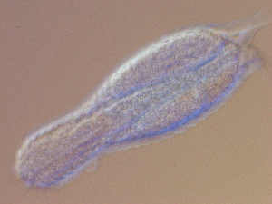  (Chaetonotida - HA_24.164)  @11 [ ] CreativeCommons  Attribution Non-Commercial (2016) Malgorzata Kolicka Department of Animal Taxonomy and Ecology Adam Mickiewicz University Poznan