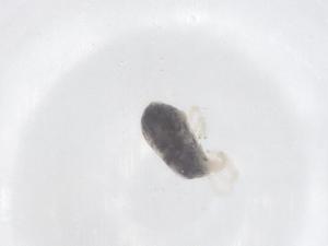  (Penthaleidae - CBG-B02984-E05)  @11 [ ] CreativeCommons - Attribution Share - Alike (2025) Centre for Biodiversity Genomics Centre for Biodiversity Genomics