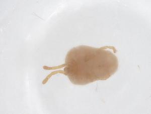  (Allothrombium pulvinum - CBG-B21334-D04)  @11 [ ] CreativeCommons - Attribution Share - Alike (2025) Centre for Biodiversity Genomics Centre for Biodiversity Genomics