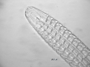  (Pselionema annulatum - 6T29K17)  @11 [ ] CreativeCommons  Attribution Non-Commercial Share-Alike (2022) Marine Biology Laboratory, Ghent University Ghent University
