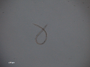  (Diplopeltinae - 7E8L15)  @11 [ ] c (2015) Ellen Pape Ugent