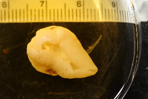  ( - ZMBN_131597)  @11 [ ] CreativeCommons - Attribution Non-Commercial Share-Alike (2019) University of Bergen Natural History Collections