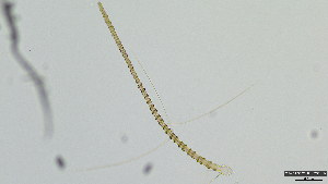  (Rheotanytarsus sp. 6XL - HKU31)  @11 [ ] Copyright (2025) Mathew Stephen Seymour The University of Hong Kong