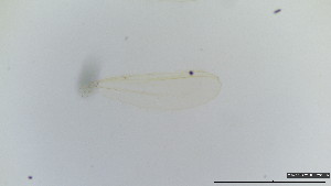  (Polypedilum cf. albicorne - HKU73)  @11 [ ] Copyright (2025) Mathew Stephen Seymour The University of Hong Kong