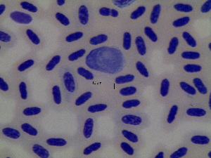  (Leucocytozoon fringillinarum - OT428_MYFUM01)  @11 [ ] CreativeCommons - Attribution Non-Commercial Share-Alike (2019) Unspecified Universidad Nacional de Colombia