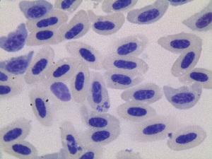  (Plasmodium hermani - OT 629_TRPER01)  @11 [ ] CreativeCommons - Attribution Non-Commercial Share-Alike (2014) Unspecified GERPH