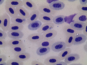  (Plasmodium homopolare - OT 785_BACOR01)  @11 [ ] CreativeCommons - Attribution Non-Commercial Share-Alike (2019) Unspecified Universidad Nacional de Colombia