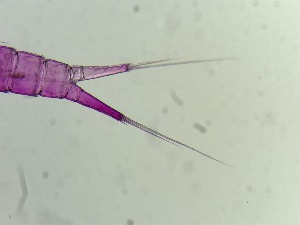  (Parathalestris croni - 0016.1)  @11 [ ] Creative Commons BY NC SA (2022) University of Bergen Natural History Collections