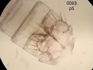  (Paramphiascella hispida - 0063.1)  @11 [ ] Creative Commons BY NC SA (2022) University of Bergen Natural History Collections