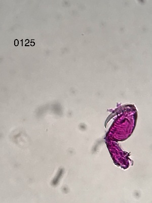  ( - 0125.1)  @11 [ ] Creative Commons BY NC SA (2022) University of Bergen Natural History Collections