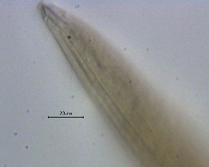  (Dorylaimopsis cf. rabalaisi - OUCJ100525)  @11 [ ] CreativeCommons - Attribution Non-Commercial Share-Alike (2021) Hong Zhou Ocean University of China