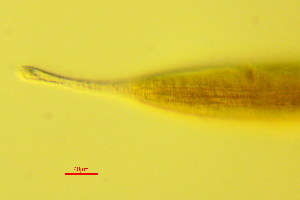  (Dorylaimopsis sp - OUCDZ35B)  @11 [ ] CreativeCommons - Attribution Non-Commercial Share-Alike (2016) Hong Zhou Ocean University of China