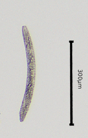  (Mesocriconema solivagum - BGE_00645_B04)  @11 [ ] CreativeCommons - Attribution Share - Alike (2025) Unspecified Unspecified
