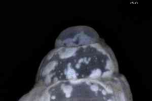  ( - ZMBN_148955)  @11 [ ] Creative Commons BY NC SA (2025) University of Bergen Natural History Collections