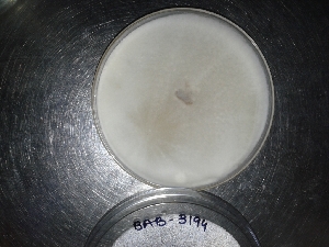  (Tricoderma erinaceum - BAB 3194)  @11 [ ] Copyright (2014) Gujarat Biodiversity Gene Bank, GSBTM, DST, GoG Gujarat Biodiversity Gene Bank, GSBTM, DST, GoG