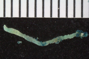  ( - ZMBN_107428)  @11 [ ] CreativeCommons - Attribution Non-Commercial Share-Alike (2016) University of Bergen University of Bergen, Natural History Collections
