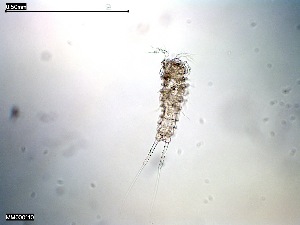  (Arthropsyllus - MM000110_crustaceans_Harpacticoida_Ancorabolidae)  @11 [ ] © (2020) Dr. Nancy F. Mercado Salas German Center for Marine Biodiversity Research