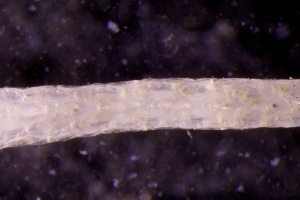  ( - ZMBN_146128)  @11 [ ] Creative Commons BY SA (2024) University of Bergen Natural History Collections