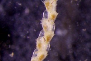  (Notoplites - ZMBN_166206)  @11 [ ] Creative Commons BY SA (2024) University of Bergen Natural History Collections