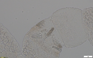  (Tetrastemma sp. SMGM015 - GLTZ-0244)  @11 [ ] copyright (2024) Svetlana Maslakova University of Oregon