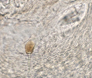  ( - GLTZ-0257)  @11 [ ] Copyright (2024) Svetlana Maslakova Oregon Institute of Marine Biology