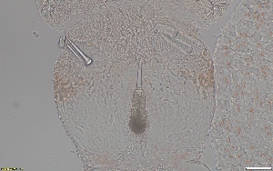  (Tetrastemma sp. SMGM006 - GLTZ-0256)  @11 [ ] copyright (2024) Svetlana Maslakova University of Oregon