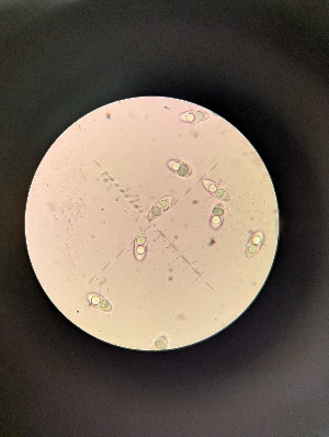  (Halosphaeriopsis - M24MAR0026D1_FB112)  @11 [ ] by-sa (2025) Norwegian marine fungi Institute of marine research