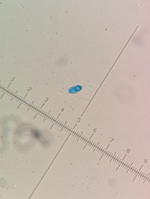  (Sablicola - M24BEP0178D2_FB125)  @11 [ ] by-sa (2025) Norwegian marine fungi Institute of marine research