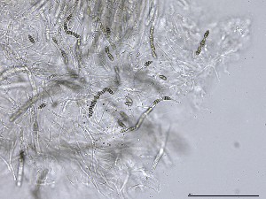  (Melanomma - M24NMF0020c_NMF210_Culture)  @11 [ ] by-sa (2025) Norwegian marine fungi UiT The Arctic University of Norway