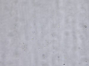  (Bionectriaaceae - M23NMF0049a_NMF190_Culture)  @11 [ ] by-sa (2025) Norwegian marine fungi UiT The Arctic University of Norway