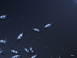  (Parastagonospora - OHa2023-08.03C)  @11 [ ] by-sa (2025) Norwegian marine fungi Institute of marine research