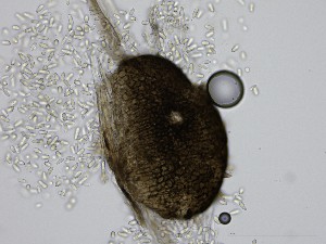  (Neocamarosporium calvescens - SG2023-29_NMF146_Culture)  @11 [ ] by-sa (2025) Norwegian marine fungi UiT The Arctic University of Norway