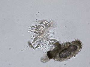  ( - M23NMF0049d_FB45)  @11 [ ] by-sa (2025) Norwegian marine fungi UiT The Arctic University of Norway