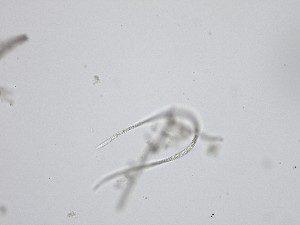  ( - M24NMF0002D1a_NMF147_Culture)  @11 [ ] by-sa (2025) Norwegian marine fungi UiT The Arctic University of Norway