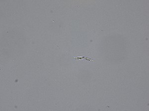  ( - M23NMF0049d_NMF212_Culture)  @11 [ ] by-sa (2025) Norwegian marine fungi UiT The Arctic University of Norway