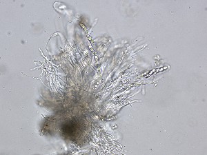  (Morosphaeriaceae - IRe2023-01_NMF224_Culture)  @11 [ ] by-sa (2025) Norwegian marine fungi UiT The Arctic University of Norway